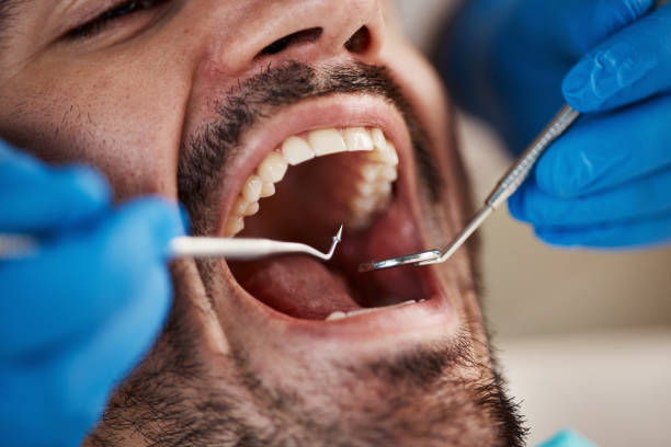 Best Emergency Care for Gum Disease in Oakland City, IN